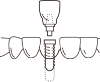 showcase icon
