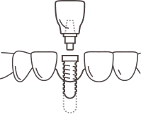 showcase icon